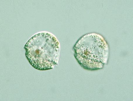 Protist Images: Gymnodinium