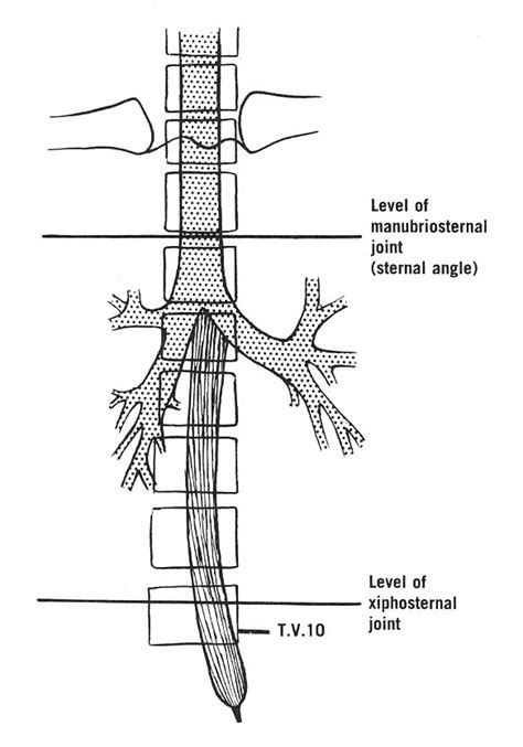 Doctors Gates Trachea And Esophagus In Relation To Vertebral And