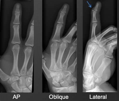 Radiology Ii Msk Intro Flashcards Quizlet