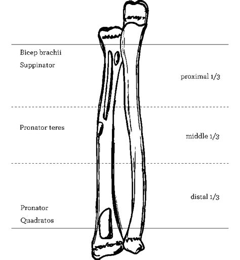 Anatomy Of The Forearm With The Insertion Point Of The Main Muscles