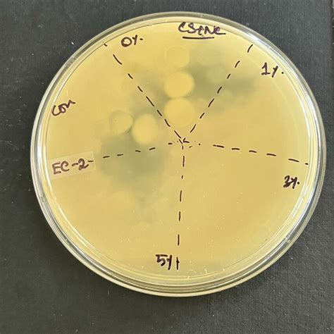 Lb Agar Recipe Sigma Bryont Blog