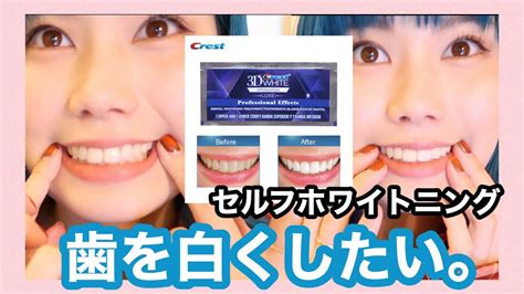 【セルフホワイトニング】歯を白くしたい。3d Whiteが凄すぎた Youtube