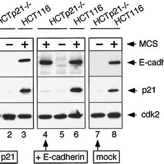 Effects Of P21 Antisense Oligonucleotides On E Cadherin Induction And