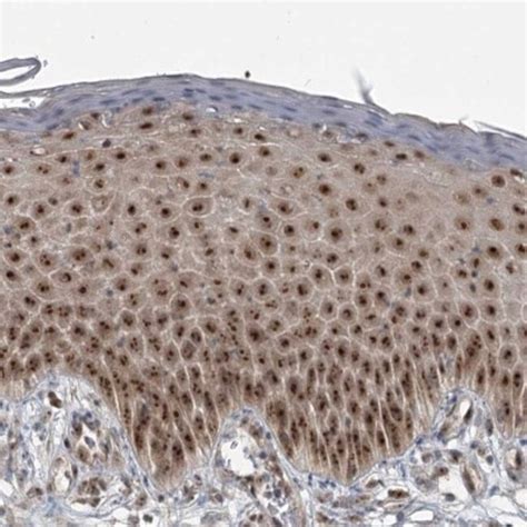 Exosome component 1 Antibody, Novus Biologicals 0.1mL; Unlabeled:Antibodies, | Fisher Scientific