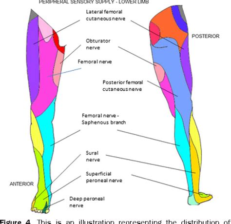 Figure 4 From Postpartum Spinal Cord Root Plexus And Peripheral Nerve Injuries Involving The