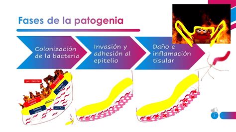 Fisiopatologia Del Helicobacter Pylori Youtube