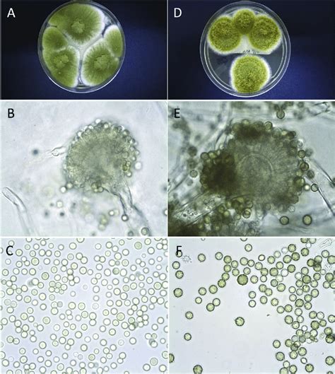 Macroscopic Colonies On Sabouraud Agar At 37 C After 4 Days Of