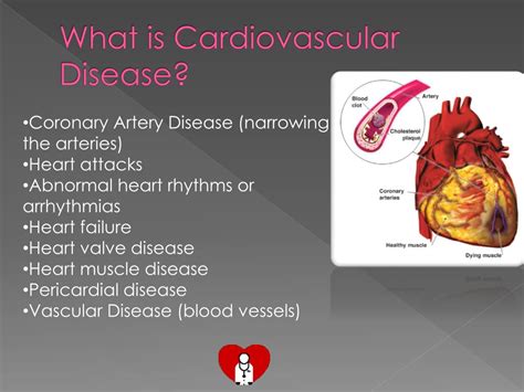 Ppt Cardiovascular Disease Powerpoint Presentation Free Download Id 2812209