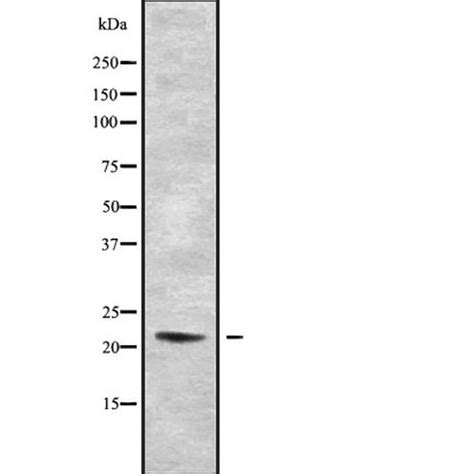 Relaxin 2 Polyclonal Antibody Invitrogen™ 100 μl Unconjugated Primary