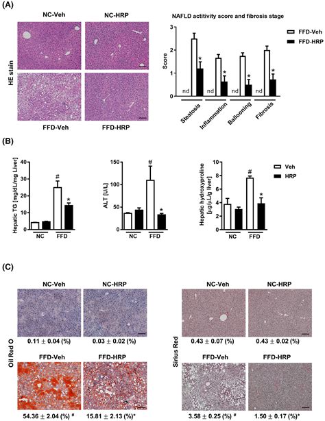 Pro Renin Receptor Inhibition Attenuated Liver Steatosis Inflammation