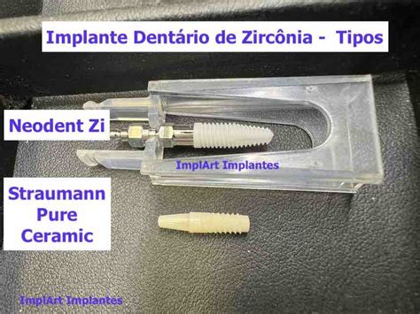 Implante De Zirconia Straumann Pure Neodent Zi 2 Implart