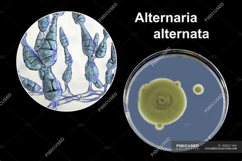 Digital Illustration Of Fungal Morphology Of Filamentous Allergenic