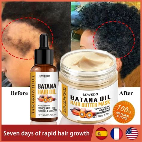 Leo De Batana Natural Para O Tratamento Do Cabelo Saud Vel Promove O