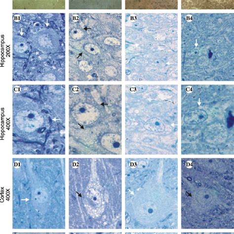 Histochemical And Histopathological Analysis Of Brain Animals And