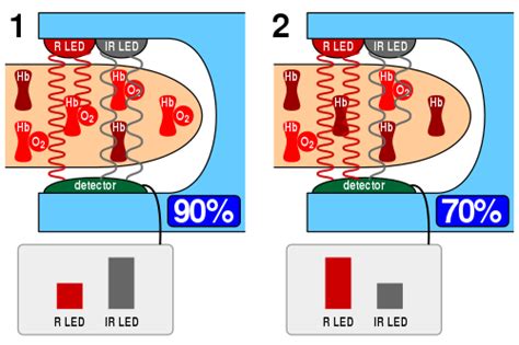 Pulse Oximetry Wikipedia