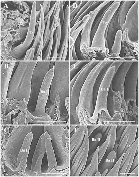 Scanning Electron Micrographs Of Trichoid Sensilla And Basiconic