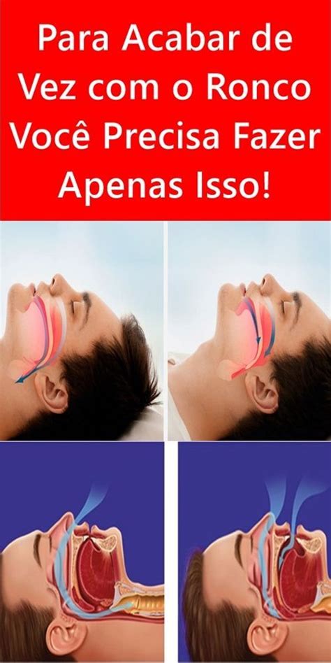 O Que Fazer Para Diminuir Ronco - Para Acabar de Vez com o Ronco Você Precisa Fazer Apenas Isso! | Ronco ...