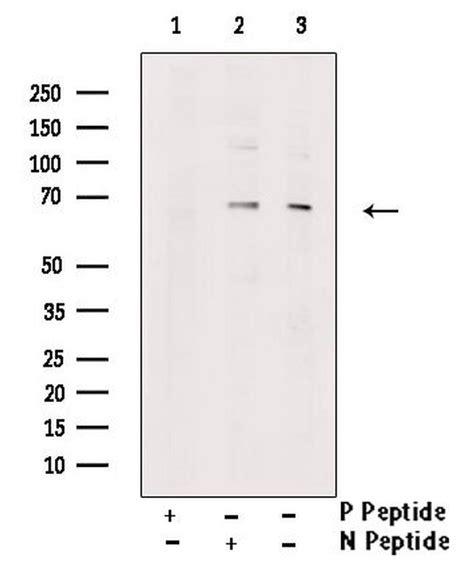 Phospho Pink1 Ser228 Polyclonal Antibody Pa5 105356