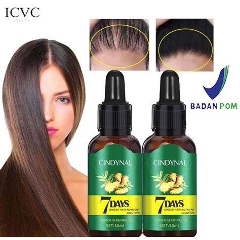 Jual BPOM Penumbuh Rambut Cepat Serum Anti Botak Penipisan Rontok Hair