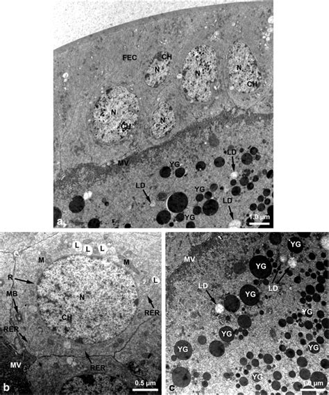 Ac Electron Micrographs Of Vitellogenic Oocytes Of Normal Adult Female