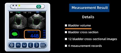 choose   bladder scanner comprehensive guide bladgo
