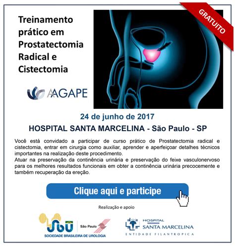 Curso De Prostatectomia Radical E Cistectomia SBU SP