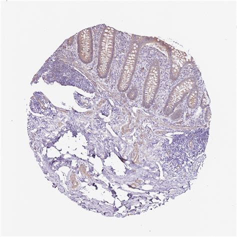 Tissue Expression Of Gfral Staining In Appendix The Human Protein Atlas