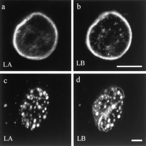 Double Label Immunofluorescence Showing Nuclear Lamin Patterns In A Download Scientific Diagram