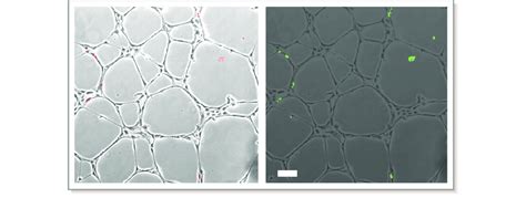 Example Of Circulating Angiogenic Cell Cac Association With Human