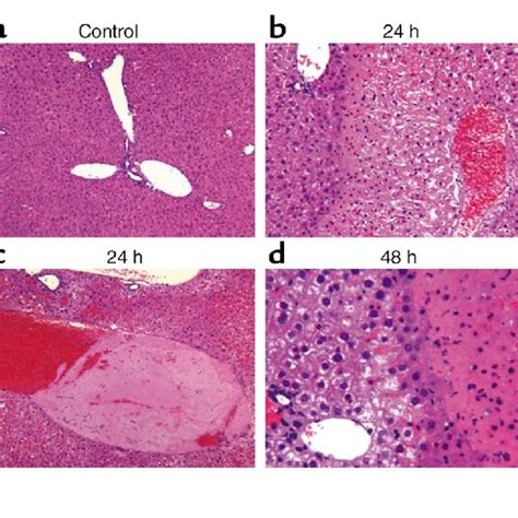 Histopathological Analysis Of Lt Treated Balb Cj Mouse Spleen A Red