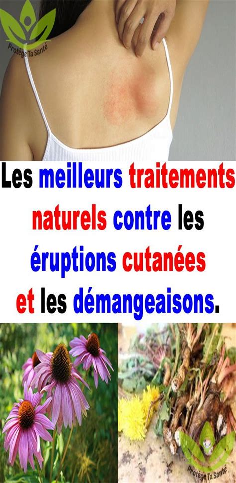 Les Meilleurs Traitements Naturels Contre Les éruptions Cutanées Et Les