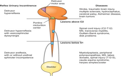 Alterations Of Renal And Urinary Tract Function Flashcards Quizlet