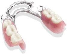 Types of Partial Dentures: Maritza O Jenkins, DMD: General Dentist