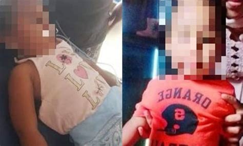 Niña De Bilwi Que Junto A Su Hermanito Ingirió Comida Envenenada Sigue