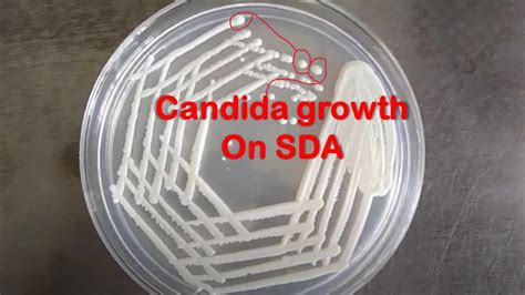 Candida Albicans Colony Characteristics On Sabouraud Dextrose Agar SDA