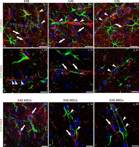 Representative Images Of Neocortex Sections Double Immunostained For