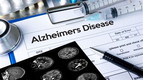 Biogen Pushes Ahead With Alzheimers Drug Despite Mixed Results