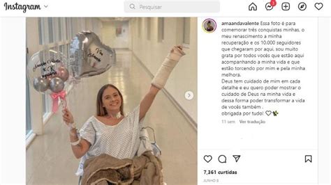 Influencer Que Perdeu Perna Ao Fugir De Assalto Privil Gio Estar Viva