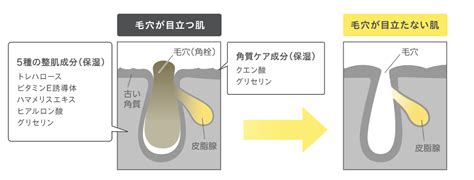 kose