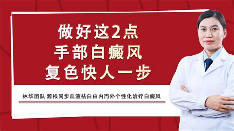 白癜风治疗新技术：做好这2点，手部白癜风复色快人一步 哔哩哔哩