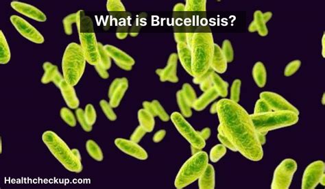 Brucellosis - Symptoms, Diagnosis, Treatment, Prevention