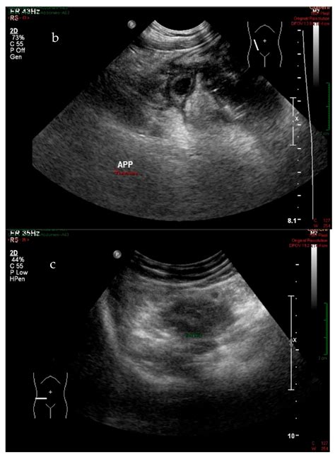 Applied Sciences Free Full Text Evaluation Of Ultrasound Accuracy