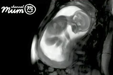 Amazing Video Mri Shows Unborn 20 Week Old Child Stretch And Move