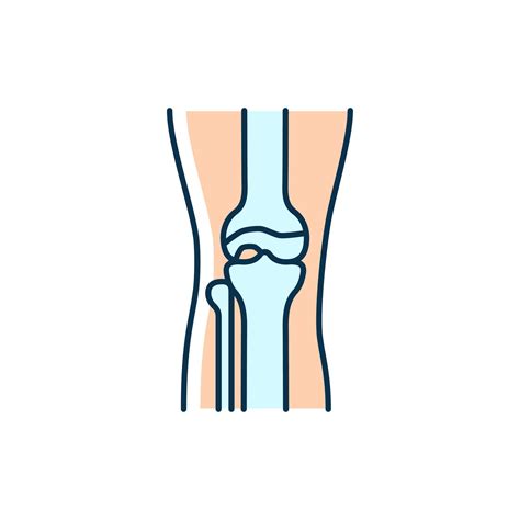 icono de color rgb de osteoartritis inflamación del cartílago