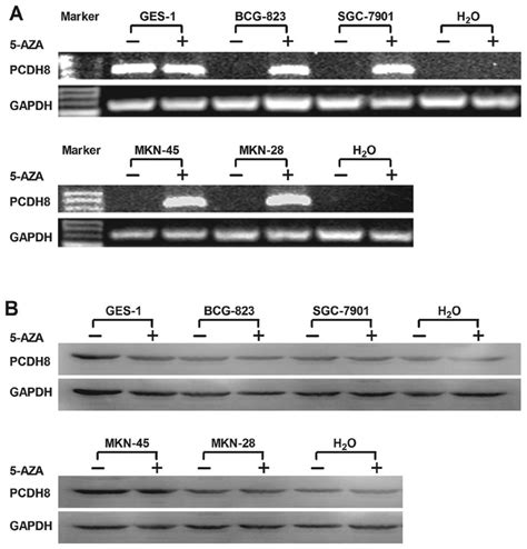 Frequent Silencing Of Protocadherin 8 By Promoter Methylation A