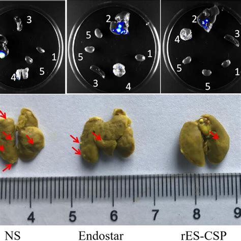 Tumor Metastasis In Nude Mice Bearing Orthotopic Xenograft Tumor A The