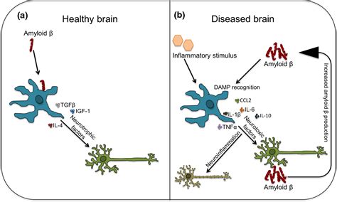 The Role Of Innate Immune Responses And Neuroinflammation In Amyloid