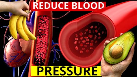 ⚡top 5 Potassium Rich Foods That Reduce Blood Pressure Youtube