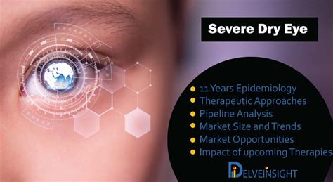 Severe Dry Eye Market Insight Epidemiology And Market For Flickr