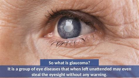 Glaucoma And Its Various Treatment Options